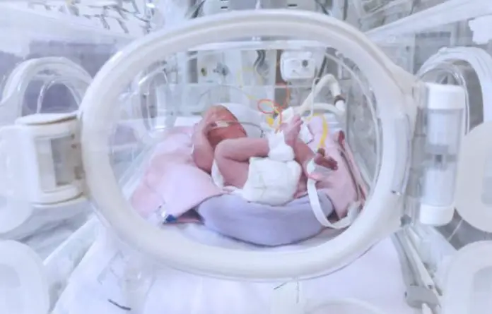 Risks Premature Babies Can Be Faced With