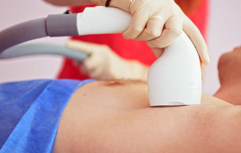 What’s The Simplest Procedure For Hair Removal For Men?