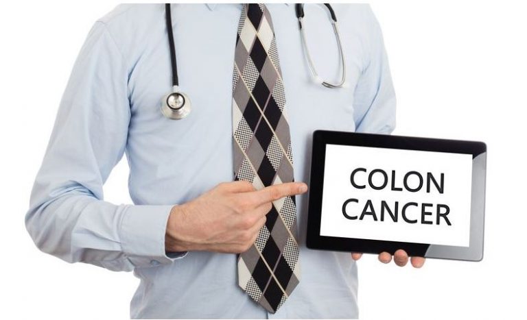 7 Risk Factors Of Colon Cancer And How To Reduce Them