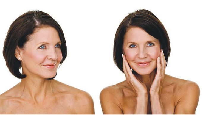 Types Of Facelifts – What Suits You Best?