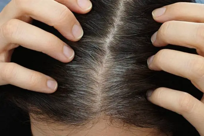 How To Get Rid Of Greying Hair Without Dyeing It