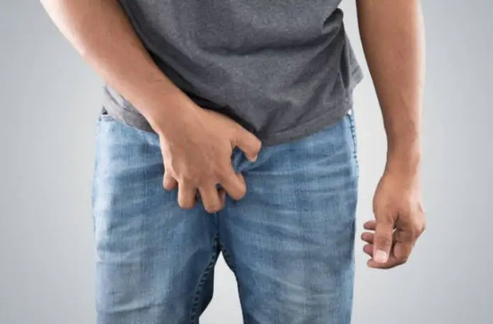 Male Yeast Infection - Why It Happens And How To Avoid It