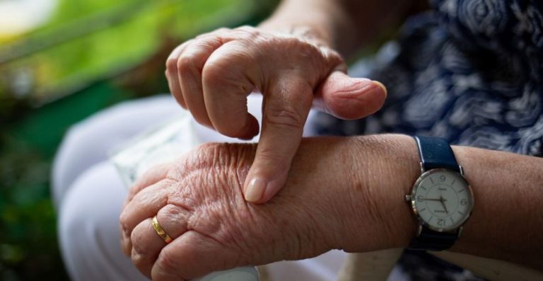 Alternative Treatments For Arthritis